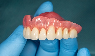 a person holding a denture with blue latex gloves on