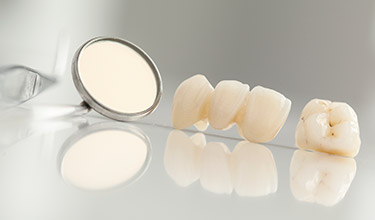 dental crown and bridge on table