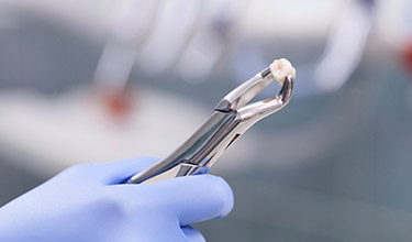hand holding extracted tooth with a tool