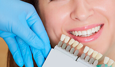 dental hygienist comparing white teeth to stained teeth model