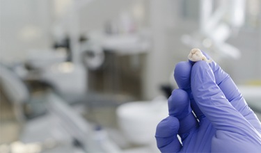 Dentist holding an extracted tooth