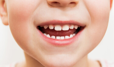 closeup of kid showing teeth