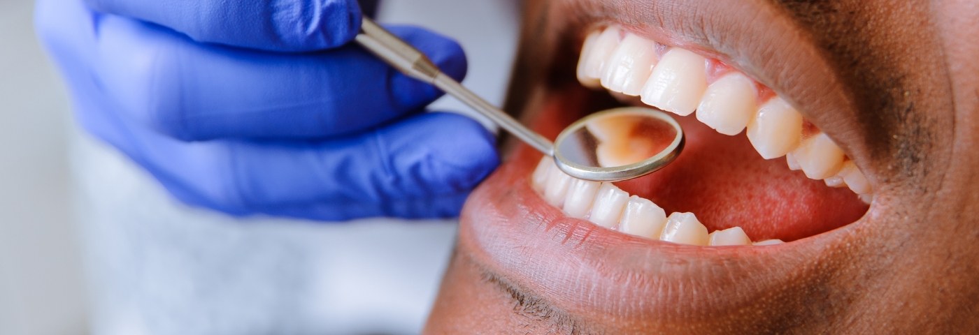 Close up of mouth during dental checkup in Carrollton