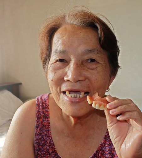 Lady shows removable denture