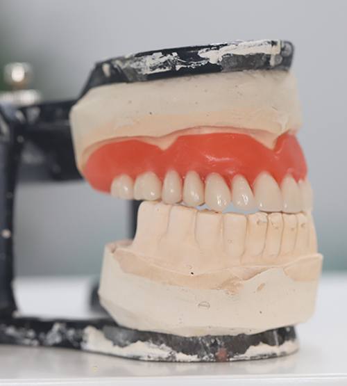 Upper denture on mouth mold held by clamp