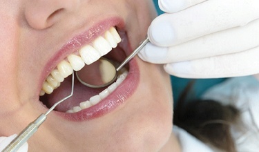 A woman having her teeth examined