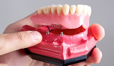 Dentist holding model of implant dentures in Carrollton 
