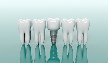 Model teeth next to model single tooth dental implant in Carrollton