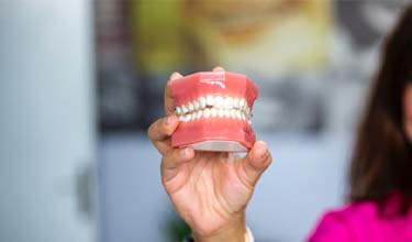 Woman holding dental mold with clear aligners