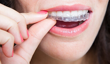 woman putting Invisalign clear braces on