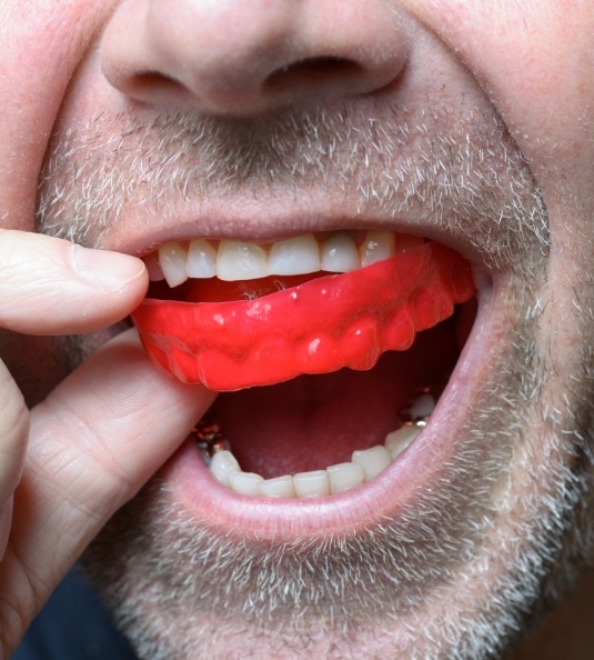 Man putting in a red nightguard