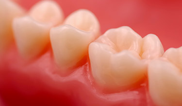 closeup of perfectly filled teeth