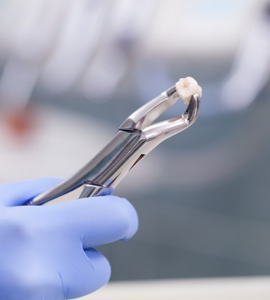 Gloved hands holding forceps and extracted tooth