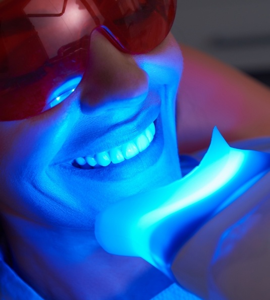 Close up of smile during in office whitening