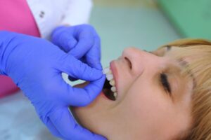 Dentist applying veneers to patient.