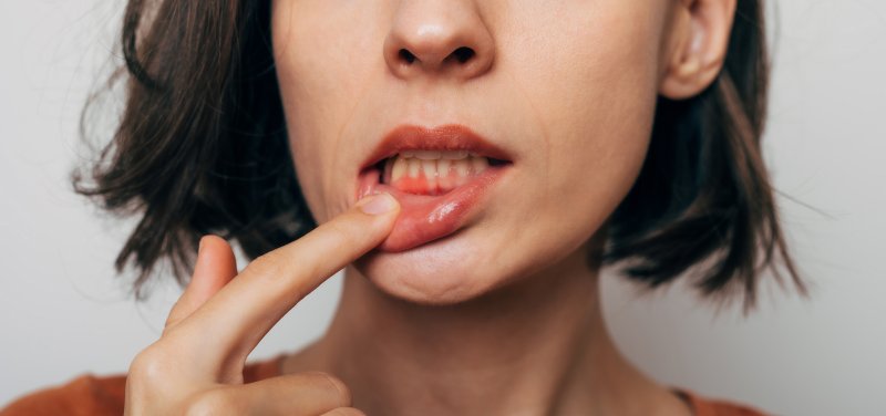 Lady shows inflamed gum tissue